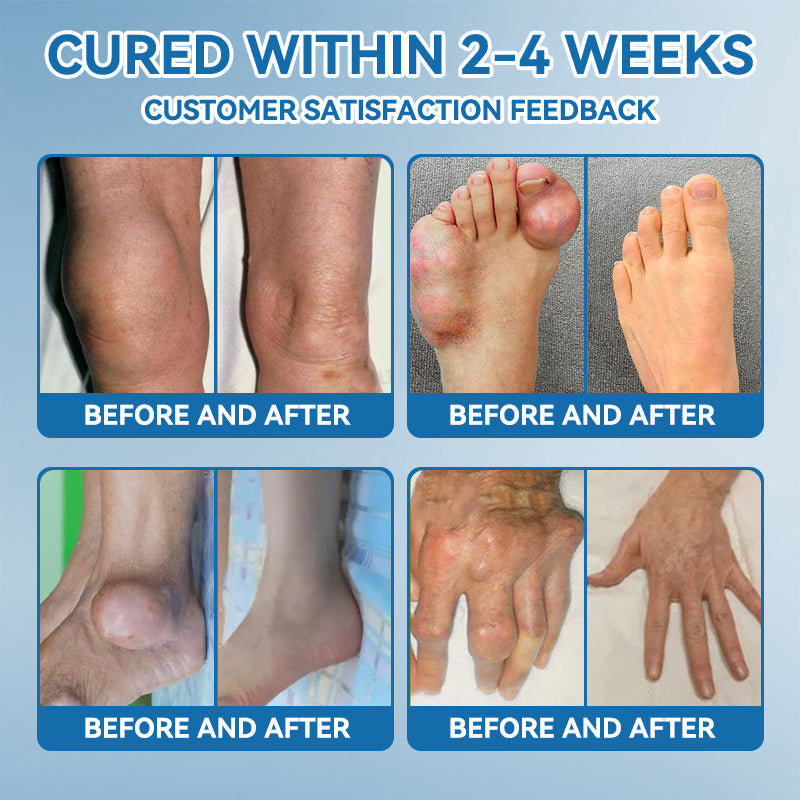 𝐀𝐞𝐞𝙝𝙛𝗲𝗻𝗴® BPC-157 Joint Healing Cream🦴Treats Arthritis, Neuropathy, Rheumatism, Sports Injuries & More 🤍