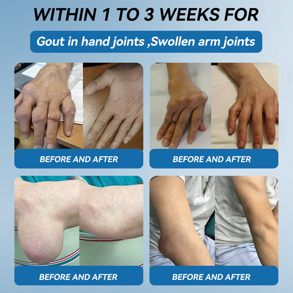 𝐀𝐞𝐞𝙝𝙛𝗲𝗻𝗴® BPC-157 Joint Healing Cream🦴Treats Arthritis, Neuropathy, Rheumatism, Sports Injuries & More 🤍
